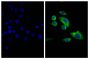 Human pancreatic carcinoma cell line MIA PaCa-2 was stained with Mouse Anti-Cytokeratin 18-UNLB (SB Cat. No. 10085-01; right) followed by Goat F(ab')<sub>2</sub> Anti-Mouse IgG<sub>2b</sub>, Human ads-FITC (SB Cat. No. 1092-02) and DAPI.