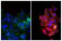 Human epithelial carcinoma cell line HEp-2 was stained with Mouse Anti-Cytokeratin 18-UNLB (SB Cat. No. 10085-01; right) and Mouse Anti-Human CD44-FITC (SB Cat. No. 9400-02) followed by Goat Anti-Mouse IgG<sub>2b</sub>, Human ads-TXRD (SB Cat. No. 1090-07) and DAPI.