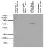 Recombinant influenza proteins were resolved by electrophoresis, transferred to PVDF membrane, and probed with Mouse Anti-Influenza A, Nucleoprotein-UNLB (SB Cat. No. 10770-01).  Proteins were visualized using Goat Anti-Mouse IgG, Human ads-HRP (SB Cat. No. 1030-05) and chemiluminescent detection.