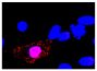 A549 cells infected with influenza H1N1 strain NC2 8 hours post infection were stained with Mouse Anti-Influenza A, Nucleoprotein-UNLB (SB Cat. No. 10780-01) followed by an AF555 conjugated secondary antibody and DAPI.<br/>Image from Farooqui A, Leon AJ, Lei Y, Wang P, Huang J, Tenorio R, et al. Heterogeneous virulence of pandemic 2009 influenza H1N1 virus in mice. Virol J. 2012;9:104. Figure 1(c)<br/>Reproduced under the Creative Commons license https://creativecommons.org/licenses/by/2.0/