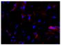 Frozen equine sacroid tissue section was stained with anti-MHC I followed by Goat Anti-Mouse IgG<sub>2a</sub>, Human ads-TRITC (SB Cat. No. 1080-03) and DAPI.<br/>Image from Wilson AD, Hicks C. Both tumour cells and infiltrating T-cells in equine sarcoids express FOXP3 associated with an immune-supressed cytokine microenvironment. Vet Res. 2016;47:55. Figure 5(h)<br/>Reproduced under the Creative Commons license https://creativecommons.org/licenses/by/4.0/