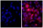 Human pancreatic carcinoma cell line MIA PaCa-2 was blocked with 10% Normal Goat Serum (SB Cat. No. 0060-01) and stained with Mouse Anti-Cytokeratin 18-UNLB (SB Cat. No. 10085-01; right) followed by Goat Anti-Mouse IgG(H+L), Human ads-AF555 (SB Cat. No. 1031-32) and DAPI.
