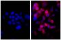 Human pancreatic carcinoma cell line MIA PaCa-2 was stained with Mouse Anti-Cytokeratin 18-UNLB (SB Cat. No. 10085-01; right) followed by Goat Anti-Mouse IgG(H+L), Human/Bovine/Horse SP ads-AF555 (SB Cat. No. 1037-32) and DAPI.