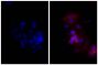 Human epithelial carcinoma cell line HEp-2 was stained with Mouse Anti-Human CD44-UNLB (SB Cat. No. 9400-01; right) followed by Goat Anti-Mouse IgG, Human ads-TXRD (SB Cat. No. 1030-07) and DAPI.