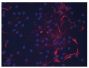 Human dermal fibroblasts stimulated with unstimulated macrophages for 72 h were stained with anti-collagen type I followed by Goat Anti-Mouse IgG<sub>1</sub>, Human ads-BIOT (SB Cat. No. 1070-08), CY3 conjugated Streptavidin, and DAPI.<br/>Image from Ploeger DT, Hosper NA, Schipper M, Koerts JA, de Rond S, Bank RA. Cell plasticity in wound healing: paracrine factors of M1/ M2 polarized macrophages influence the phenotypical state of dermal fibroblasts. Cell Commun Signal. 2013;11:29. Figure 7(b)<br/>Reproduced under the Creative Commons license https://creativecommons.org/licenses/by/2.0/