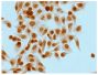 Human pancreatic carcinoma cell line MIA PaCa-2 was stained with Mouse Anti-Acetyl-Histone H3 (Lys4)-UNLB (SB Cat. No. 13600-01) followed by Goat Anti-Mouse IgG<sub>2b</sub>, Human ads-HRP (SB Cat. No. 1090-05), DAB, and mounted with Fluoromount-G<sup>®</sup> (SB Cat. No. 0100-01).