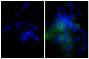 Human epithelial carcinoma cell line HEp-2 was stained with Mouse Anti-Human CD44-UNLB (SB Cat. No. 9400-01; right) followed by Goat Anti-Mouse IgG, Human ads-AF488 (SB Cat. No. 1030-30) and DAPI.