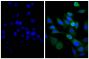 Human pancreatic carcinoma cell line MIA PaCa-2 was stained with Mouse Anti-Cytokeratin 18-UNLB (SB Cat. No. 10085-01; right) followed by Goat Anti-Mouse IgG(H+L), Human/Bovine/Horse SP ads-BIOT (SB Cat. No. 1037-08), Streptavidin-FITC (SB Cat. No. 7100-02), and DAPI.