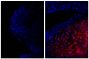 Frozen newborn mouse cartilage section was stained with Goat Anti-Type II Collagen-UNLB (SB Cat. No. 1320-01; right) followed by Donkey Anti-Goat IgG(H+L), Mouse/Rat SP ads-AF555 (SB Cat. No. 6420-32) and DAPI.