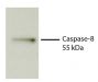 Total cell lysates from Jurkat cells were incubated with STS, resolved by electrophoresis, transferred to PVDF membrane, and probed with Rat Anti-Human Caspase-8-UNLB (SB Cat. No. 17300-01). Proteins were visualized using Goat Anti-Rat IgM-HRP (SB Cat. No. 3020-05) secondary antibody and chemiluminescent detection.