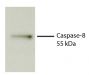 Total cell lysates from Jurkat cells were incubated with STS, resolved by electrophoresis, transferred to PVDF membrane, and probed with Rat Anti-Human Caspase-8-UNLB (SB Cat. No. 17300-01).  Proteins were visualized using Goat Anti-Rat IgM-HRP (SB Cat. No. 3020-05) secondary antibody and chemiluminescent detection.