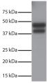 Total cell lysates from Jurkat cells were resolved by electrophoresis, transferred to PVDF membrane, and probed with Rabbit Anti-Human DR5-UNLB (SB Cat. No. 6600-01).  Proteins were visualized using Goat Anti-Rabbit IgG(H+L), Mouse/Human ads-HRP (SB Cat. No. 4050-05) secondary antibody and chemiluminescent detection.