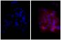 Human epithelial carcinoma cell line HEp-2 was stained with Mouse Anti-Human CD44-UNLB (SB Cat. No. 9400-01; right) followed by Goat Anti-Mouse Ig, Human ads-TXRD (SB Cat. No. 1010-07) and DAPI.