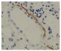 Paraffin embedded tubular basement membrane tissue section from patients with Anti-GBM disease was stained with Mouse Anti-Human IgG<sub>3</sub> Hinge-UNLB (SB Cat. No. 9210-01) followed by an HRP conjugated secondary antibody and DAB.<br/>Image from Qu Z, Cui Z, Liu G, Zhao M. The distribution of IgG subclass deposition on renal tissues from patients with anti-glomerular basement membrane disease. BMC Immunol. 2013;14:19. Figure 1(f)<br/>Reproduced under the Creative Commons license https://creativecommons.org/licenses/by/2.0/