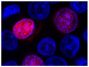 HEK293T cells transfected with p.G120C-mRFP-ICK were mounted with DAPI Fluoromount-G<sup>®</sup> (SB Cat. No. 0100-20).<br/>Image from Oud MM, Bonnard C, Mans DA, Altunoglu U, Tohari S, Ng AY, et al. A novel ICK mutation causes ciliary disruption and lethal endocrine-cerebro-osteodysplasia syndrome. Cilia. 2016;5:8. Figure 2(a)<br/>Reproduced under the Creative Commons license https://creativecommons.org/licenses/by/4.0/