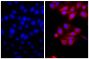 Human pancreatic carcinoma cell line MIA PaCa-2 was stained with Mouse Anti-Cytokeratin 18-UNLB (SB Cat. No. 10085-01; right) followed by Goat Anti-Mouse IgG(H+L), Rat ads-TXRD (SB Cat. No. 1034-07) and DAPI.
