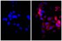 Human pancreatic carcinoma cell line MIA PaCa-2 was stained with Mouse Anti-Cytokeratin 18-UNLB (SB Cat. No. 10085-01; right) followed by Goat Anti-Mouse IgG(H+L), Rat ads-AF555 (SB Cat. No. 1034-32) and DAPI.