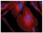 Human astrocytoma cell line CCF-STTG1 was stained with Mouse Anti-Human GFAP-CY3 (SB Cat. No. 12075-12) and DAPI.