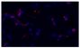 Frozen equine sacroid tissue section was stained with anti-CD8 followed by Goat Anti-Mouse IgG<sub>3</sub>, Human ads-TRITC (SB Cat. No. 1100-03) and DAPI.<br/>Image from Wilson AD, Hicks C. Both tumour cells and infiltrating T-cells in equine sarcoids express FOXP3 associated with an immune-supressed cytokine microenvironment. Vet Res. 2016;47:55. Figure 2(g)<br/>Reproduced under the Creative Commons license https://creativecommons.org/licenses/by/4.0/