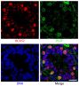 Paraffin embedded sections of mouse P8 testes were stained with anti-BCAS2 and anti-PLZF. The DNA was stained with Hoechst 33342 and mounted with Fluoromount-G<sup>®</sup> (SB Cat. No. 0100-01).<br/>Images from Liu W, Wang F, Xu Q, Shi J, Zhang X, Liu X, et al. BCAS2 is involved in alternative mRNA splicing in spermatogonia and the transition to meiosis. Nat Commun. 2017;8:14182. Figure 1(d)<br/>Reproduced under the Creative Commons license https://creativecommons.org/licenses/by/4.0/