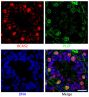 Paraffin embedded sections of mouse P8 testes were stained with anti-BCAS2 and anti-PLZF.  The DNA was stained with Hoechst 33342 and mounted with Fluoromount-G<sup>®</sup> (SB Cat. No. 0100-01).<br/>Images from Liu W, Wang F, Xu Q, Shi J, Zhang X, Liu X, et al. BCAS2 is involved in alternative mRNA splicing in spermatogonia and the transition to meiosis. Nat Commun. 2017;8:14182. Figure 1(d)<br/>Reproduced under the Creative Commons license https://creativecommons.org/licenses/by/4.0/