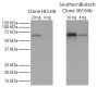 Tau-410 (2N3R) with an N-terminal 8X His-tag was resolved by electrophoresis, transferred to PVDF membrane, and probed with Mouse Anti-His-Tag-BIOT (SB Cat. No. 4603-08; Clone SB194b) and Clone HIS.H8 conjugated to biotin followed by Streptavidin-HRP (SB Cat. No. 7100-05) and chemiluminescent detection.