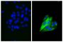 Human epithelial carcinoma cell line HEp-2 was stained with Mouse Anti-Cytokeratin 18-UNLB (SB Cat. No. 10085-01; right) followed by Goat Anti-Mouse IgG<sub>2b</sub>, Human ads-FITC (SB Cat. No. 1090-02) and DAPI.