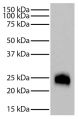 Rabbit IgG-UNLB (SB Cat. No. 0111-01) was resolved by electrophoresis under reducing conditions, transferred to PVDF membrane, and probed with Mouse Anti-Rabbit Light Chain-HRP (SB Cat. No. 4060-05) followed by chemiluminescent detection.