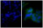 Human epithelial carcinoma cell line HEp-2 was stained with Mouse Anti-Human CD44-UNLB (SB Cat. No. 9400-01; right) followed by Goat Anti-Mouse Ig, Human ads-BIOT (SB Cat. No. 1010-08), Streptavidin-FITC (SB Cat. No. 7100-02), and DAPI.