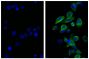 Human pancreatic carcinoma cell line MIA PaCa-2 was stained with Mouse Anti-Cytokeratin 18-UNLB (SB Cat. No. 10085-01; right) followed by Rat Anti-Mouse IgG<sub>2b</sub>-FITC (SB Cat. No. 1186-02) and DAPI.