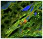 Zika virus (ZIKV) inoculated frozen mouse placenta was stained with anti-flaviviruses and anti-cytokeratin. The DNA was stained with DAPI and mounted with Fluoromount-G<sup>®</sup> (SB Cat. No. 0100-01).<br/>Image from Vermillion MS, Lei J, Shabi Y, Baxter VK, Crilly NP, McLane M, et al. Intrauterine Zika virus infection of pregnant immunocompetent mice models transplacental transmission and adverse perinatal outcomes. Nat Commun. 2017;8:14575. Figure 4(b)<br/>Reproduced under the Creative Commons license https://creativecommons.org/licenses/by/4.0/