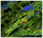 Zika virus (ZIKV) inoculated frozen mouse placenta was stained with anti-flaviviruses and anti-cytokeratin.  The DNA was stained with DAPI and mounted with Fluoromount-G<sup>®</sup> (SB Cat. No. 0100-01).<br/>Image from Vermillion MS, Lei J, Shabi Y, Baxter VK, Crilly NP, McLane M, et al. Intrauterine Zika virus infection of pregnant immunocompetent mice models transplacental transmission and adverse perinatal outcomes. Nat Commun. 2017;8:14575. Figure 4(b)<br/>Reproduced under the Creative Commons license https://creativecommons.org/licenses/by/4.0/