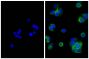 Human pancreatic carcinoma cell line MIA PaCa-2 was stained with Mouse Anti-Cytokeratin 18-UNLB (SB Cat. No. 10085-01; right) followed by Goat Anti-Mouse IgG(H+L), Multi-Species SP ads-FITC (SB Cat. No. 1038-02) and DAPI.
