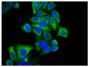 Human epithelial carcinoma cell line HEp-2 was stained with Mouse Anti-Cytokeratin 18-UNLB (SB Cat. No. 10085-01) followed by Goat Anti-Mouse IgG<sub>2b</sub>, Human/Bovine/Horse SP ads-FITC (SB Cat. No. 1093-02) and DAPI.