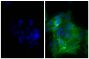 Human epithelial carcinoma cell line HEp-2 was stained with Mouse Anti-Human CD44-UNLB (SB Cat. No. 9400-01; right) followed by Goat Anti-Mouse IgG(H+L), Human ads-FITC (SB Cat. No. 1031-02) and DAPI.