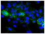 Human epithelial carcinoma cell line HEp-2 was stained with Mouse Anti-Human CD44-FITC (SB Cat. No. 9400-02S) followed by DAPI.