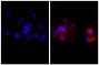 Human hepatocellular carcinoma cell line Hep G2 was stained with Rabbit IgG-UNLB isotype control (SB Cat. No. 0111-01; left) and Rabbit Anti-Human DR5-UNLB (SB Cat. No. 6600-01; right) followed by Donkey Anti-Rabbit IgG(H+L), Mouse/Rat/Human SP ads-AF555 (SB Cat. No. 6440-32) and DAPI.