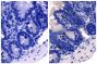 Paraffin embedded mouse small intestine section was stained with Rat Anti-Mouse IgE-UNLB (SB Cat. No. 1130-01; right) followed by an HRP conjugated secondary antibody, DAB, and hematoxylin.