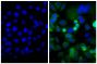 Human pancreatic carcinoma cell line MIA PaCa-2 was stained with Mouse Anti-Cytokeratin 18-UNLB (SB Cat. No. 10085-01; right) followed by Goat F(ab')<sub>2</sub> Anti-Mouse IgG(H+L), Human ads-FITC (SB Cat. No. 1032-02) and DAPI.