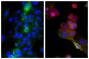 Human epithelial carcinoma cell line HEp-2 was stained with Mouse Anti-Cytokeratin 18-UNLB (SB Cat. No. 10085-01; right) and Mouse Anti-Human CD44-FITC (SB Cat. No. 9400-02) followed by Goat Anti-Mouse IgG<sub>2b</sub>, Human ads-TRITC (SB Cat. No. 1090-03) and DAPI.