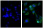 Human pancreatic carcinoma cell line MIA PaCa-2 was stained with Mouse Anti-Cytokeratin 18-UNLB (SB Cat. No. 10085-01; right) followed by Goat Anti-Mouse IgG(H+L), Rat ads-BIOT (SB Cat. No. 1034-08), Streptavidin-FITC (SB Cat. No. 7100-02), and DAPI.