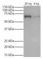 Tau-410 (2N3R) with an N-terminal 8X His-tag was resolved by electrophoresis, transferred to PVDF membrane, and probed with Mouse Anti-His-Tag-UNLB (SB Cat. No. 4603-01S) followed by Goat Anti-Mouse IgG(H+L), Human ads-HRP (SB Cat. No. 1031-05) secondary antibody and chemiluminescent detection.