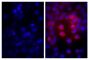 Human pancreatic carcinoma cell line MIA PaCa-2 was stained with Mouse Anti-Human CD44-BIOT (SB Cat. No. 9400-08; right) followed by Streptavidin-TXRD (SB Cat. No. 7100-07), DAPI, and mounted with Fluoromount-G<sup>®</sup> Anti-Fade (SB Cat. No. 0100-35).