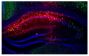 Frozen section of Pvalb-IRES-CRE mouse CA1 hippocampus injected with AAV-hM4Di-mCherry was stained with anti-parvalbumin followed by a secondary antibody and mounted with DAPI Fluoromount-G<sup>®</sup> (SB Cat. No. 0100-20).<br/>Image from Ognjanovski N, Schaeffer S, Wu J, Mofakham S, Maruyama D, Zochowski M, et al. Parvalbumin-expressing interneurons coordinate hippocampal network dynamics required for memory consolidation. Nat Commun. 2017;8:15039. Figure 2(a)<br/>Reproduced under the Creative Commons license https://creativecommons.org/licenses/by/4.0/