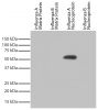 Recombinant influenza proteins were resolved by electrophoresis, transferred to PVDF membrane, and probed with Mouse Anti-Influenza A, Nucleoprotein-UNLB (SB Cat. No. 10780-01).  Proteins were visualized using Goat Anti-Mouse IgG, Human ads-HRP (SB Cat. No. 1030-05) and chemiluminescent detection.