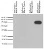 Recombinant influenza proteins were resolved by electrophoresis, transferred to PVDF membrane, and probed with Mouse Anti-Influenza B, Nucleoprotein-HRP (SB Cat. No. 10885-05). Proteins were visualized with chemiluminescent detection.
