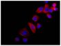 Human pancreatic carcinoma cell line MIA PaCa-2 was stained with Mouse Anti-Cytokeratin 18-UNLB (SB Cat. No. 10085-01) followed by Donkey Anti-Mouse IgG(H+L), Multi-Species SP ads-AF555 (SB Cat. No. 6415-32) and DAPI.