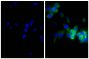 Human pancreatic carcinoma cell line MIA PaCa-2 was stained with Mouse Anti-Cytokeratin 18-UNLB (SB Cat. No. 10085-01; right) followed by Goat Anti-Mouse Kappa-BIOT (SB Cat. No. 1050-08), Streptavidin-FITC (SB Cat. No. 7100-02), and DAPI.