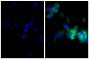 Human pancreatic carcinoma cell line MIA PaCa-2 was stained with Mouse Anti-Cytokeratin 18-UNLB (SB Cat. No. 10085-01; right) followed by Goat Anti-Mouse Kappa-BIOT (SB Cat. No. 1050-08), Streptavidin-FITC (SB Cat. No. 7100-02), and DAPI.
