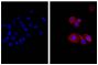 Human pancreatic carcinoma cell line MIA PaCa-2 was stained with Mouse Anti-Cytokeratin 18-UNLB (SB Cat. No. 10085-01; right) followed by Donkey Anti-Mouse IgG(H+L), Human SP ads-AF555 (SB Cat. No. 6410-32) and DAPI.